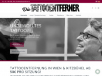 Dietattooentferner.at